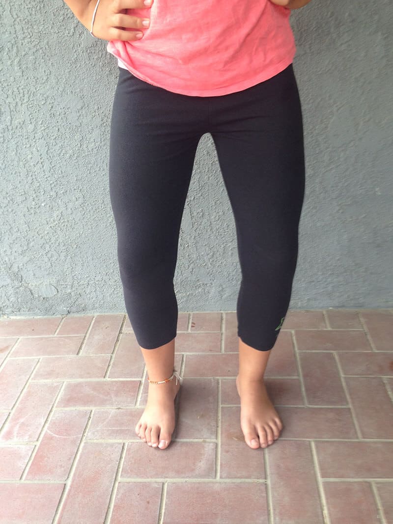Bull-Legged Example When the knee is outside of this line (bull-legged), there will be compression to the inner knee and distraction to the outer knee.